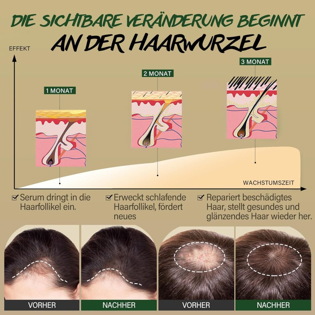 81g9FmMJjcL._SL1500_ Rosemary Biotin Hair Growth Kit